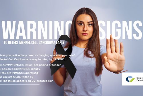 MCC campaign Merkel Cell Carcinoma